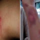 Swedish Woman Living In Seoul Gets Brutally Attacked By Locals For No Reason At All - World Of Buzz