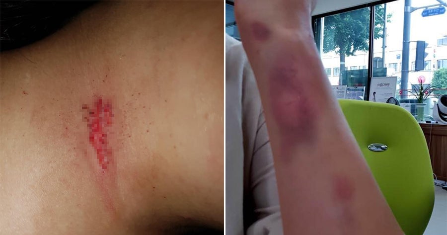 Swedish Woman Living In Seoul Gets Brutally Attacked By Locals For No Reason At All - World Of Buzz
