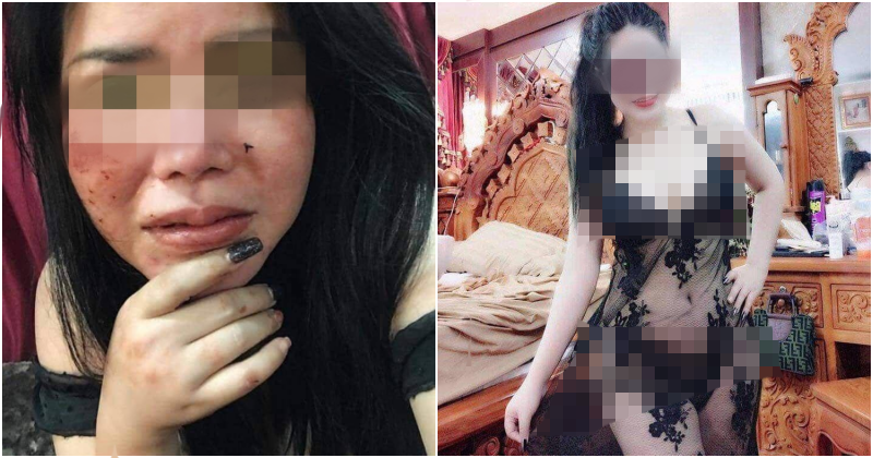 Lady Brutally Hit By Jealous Boyfriend For Posting Sexy Photos On Facebook - World Of Buzz