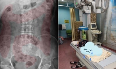 Doctor Discovers 11Yo Malaysian'S Intestines Filled With Poop, Likely Due To Habit Of Not Eating Vegetables - World Of Buzz 2