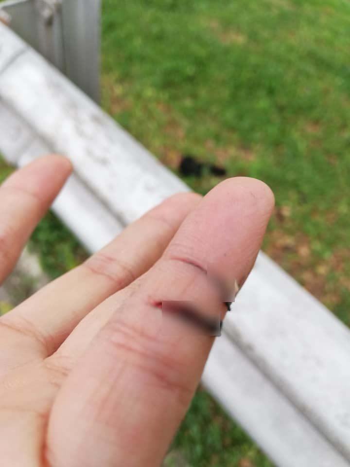 Malaysian Biker Warns Others After His Fingers Got Sliced By String Tied Around Flyover at DUKE Highway - WORLD OF BUZZ 1