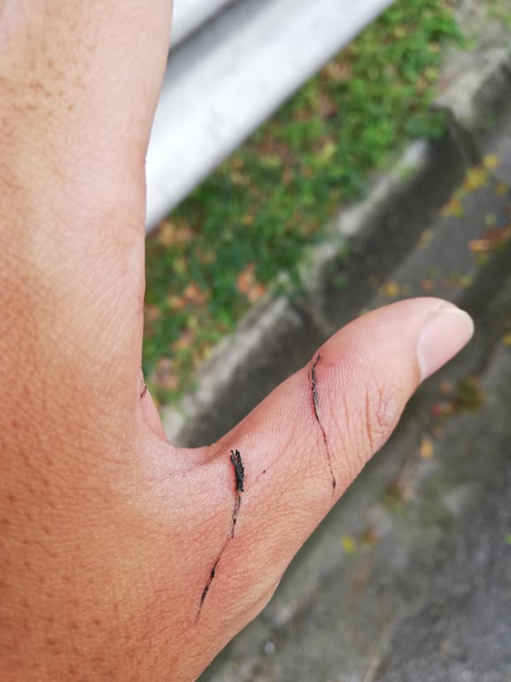 Malaysian Biker Warns Others After His Fingers Got Sliced By String Tied Around Flyover at DUKE Highway - WORLD OF BUZZ 2