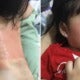 Malaysian Toddler Experiences Red &Amp; Itchy Body After Mother Forgot To Disinfect Baby Chair - World Of Buzz 2