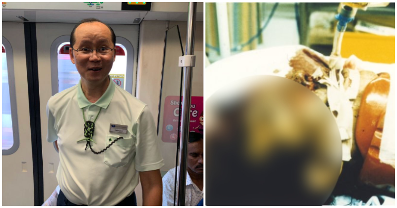 Meet Takalah Tan, The Singaporean Man With Only Half a Brain But The Positivity & Determination Of Two Men - WORLD OF BUZZ 2