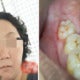 M'Sian Mother Of 2 Throws Up Black Liquid, Passes Away 5 Days After Wisdom Tooth Extraction - World Of Buzz 1