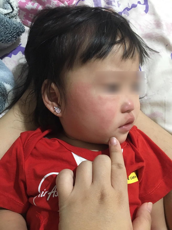 M'sian Mother Shares Why Disinfecting Baby Chair Is Important After Baby Suffers Severe Reaction - World Of Buzz 3