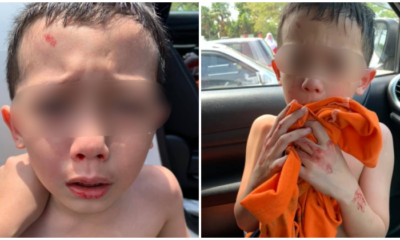7Yo Sarawakian Boy Punched In The Face By 8Yo Peer, - World Of Buzz