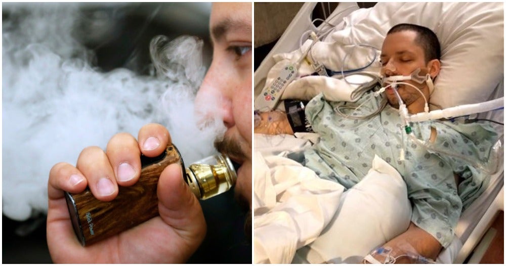 Dozens Of Us Teens Hospitalised Because Of Lung Disease Caused By Vaping - World Of Buzz 4