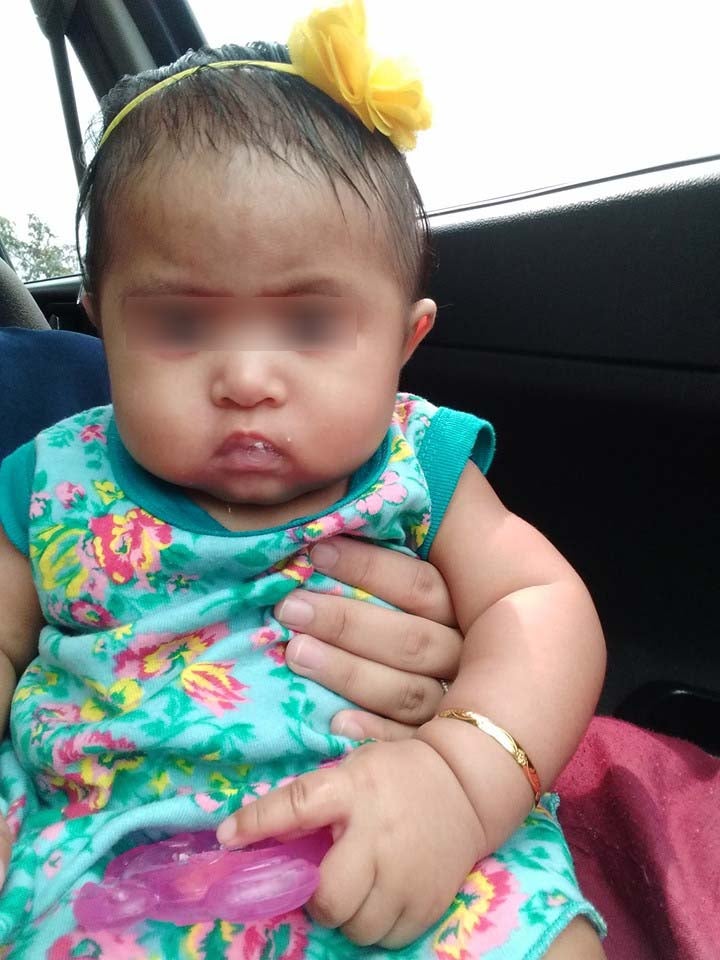 M'sian Mother Shares H Baby Contracts Severe Infection From Being Held By - WORLD OF BUZZ
