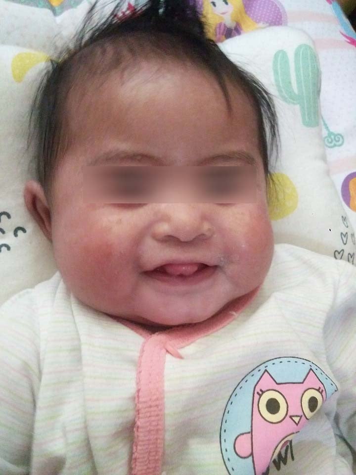 M'sian Mother Shares How Baby Contracted Severe Skin Infection From Being Held By Others - WORLD OF BUZZ 4