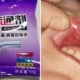 2Yo Boy Eats Pipe Cleaning Powder So Mum Flushes Mouth With Water But Burns Him Instead - World Of Buzz