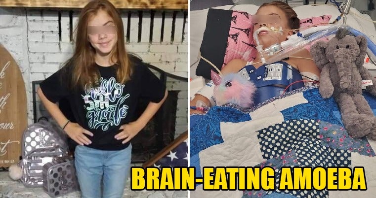 10Yo Girl Dies From Brain Infection After Amoeba Enters Nose While Swimming In River - World Of Buzz 4