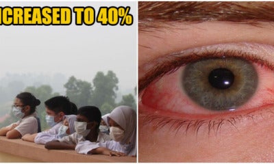 &Quot;40% Of Malaysians Are Sick Because Of Haze!&Quot; Said Moh - World Of Buzz 1