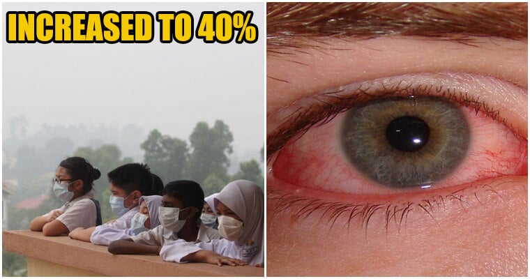 &Quot;40% Of Malaysians Are Sick Because Of Haze!&Quot; Said Moh - World Of Buzz 1