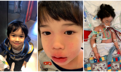4Yo Boy Only Had Pain In Leg But Was Later Diagnosed With Sepsis &Amp; Deadly Flesh-Eating Disease - World Of Buzz 1
