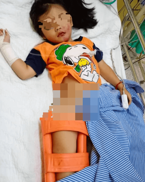 4yo M'sian Girl Falls TWO STORIES From Ferris Wheel Because Brakes Didn't Work - WORLD OF BUZZ 1