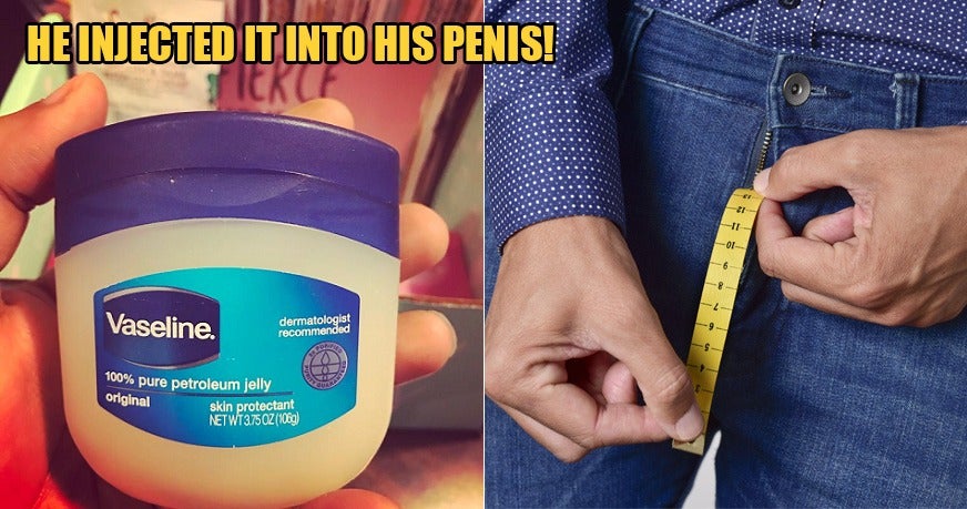 45yo Man Injected Vaseline Into His Penis To Make It Big, But Ended Up With Rotting Tissue & Pus - WORLD OF BUZZ