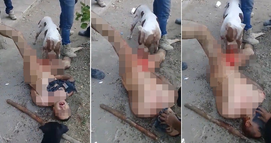 Gang Punishes Rapist By Stripping Him Naked & Allowing Dog to Tear Off His Genitals - WORLD OF BUZZ 4