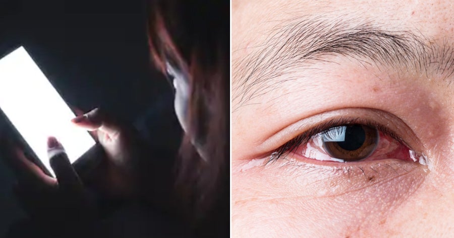 29Yo Woman Addicted To Playing Mobile Games In The Dark Egets Glaucoma - World Of Buzz
