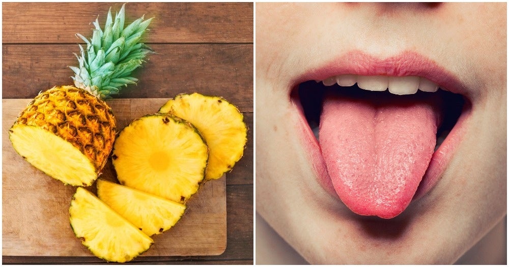 always-wondered-why-pineapples-hurt-your-tongue-when-you-eat-them-here