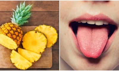 Have You Ever Wondered Why It Hurts When You Eat Pineapple? Here'S The Reason! - World Of Buzz
