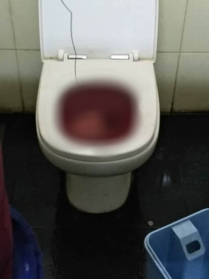 Kuantan Cleaner Tries To Unblock Clogged Toilet , Turns Out It's A Dead Baby Boy - WORLD OF BUZZ 2