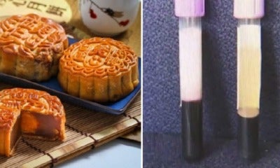 Man With Kidney Problems Ate 4 Mooncakes Almost Every Day Until His Blood Turned Milky White - World Of Buzz 2