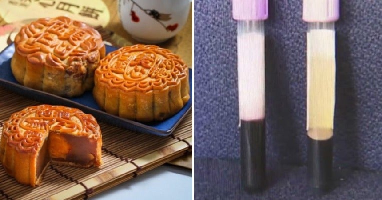 Man With Kidney Problems Ate 4 Mooncakes Almost Every Day Until His Blood Turned Milky White - World Of Buzz 2