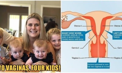 Mother With Two Vaginas &Amp; Two Wombs Delivers Four Children! - World Of Buzz 4