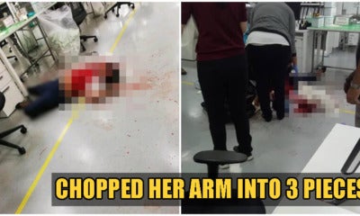 Angry Penang Employee Chops Up Woman'S Arm &Amp; Slashes Man On Last Day Of Work - World Of Buzz