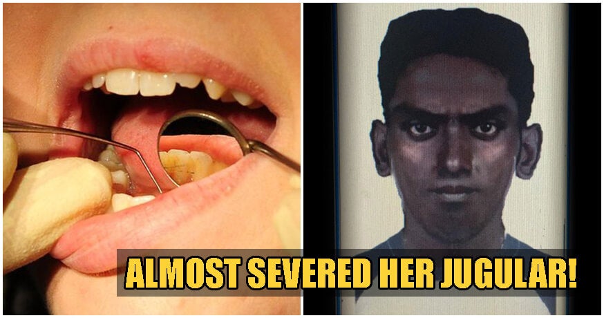 Pj Man Comes In For Root Canal, Then Slashes Dentist And Robs Her After - World Of Buzz 2