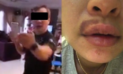 Wife Of Famous M'Sian &Quot;Tit Tar&Quot; Master Was Allegedly Domestically Abused And Beaten - World Of Buzz
