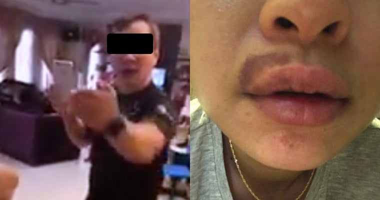 Wife of Famous M'sian "Tit Tar" Master was Allegedly Domestically Abused and Beaten - WORLD OF BUZZ