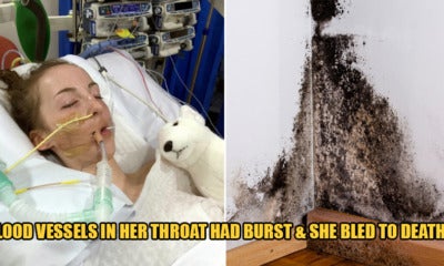 14Yo Dies After Breathing In Spores From Mould Which Ate Away The Inside Of Her Throat - World Of Buzz 1