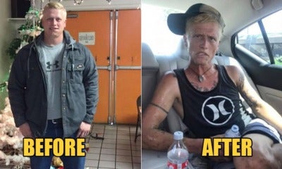 26Yo Man Goes From Looking Fit To Sickly &Amp; Haggard Within 7 Months Because Of Drug Addiction - World Of Buzz