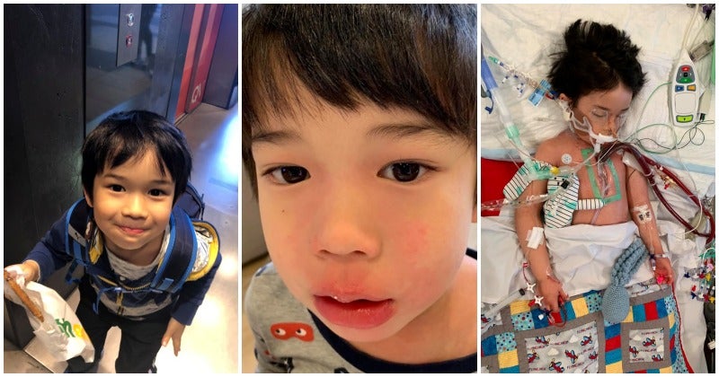 4yo boy only had pain in leg but was later diagnosed with sepsis deadly flesh eating disease world of buzz