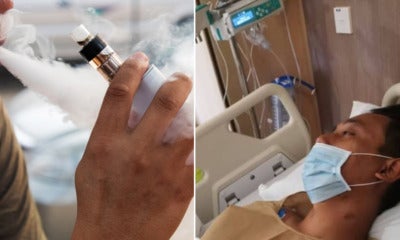 34Yo M'Sian Man Has Fluid-Like Fungus In His Lungs After Switching To Vape For 2 Weeks - World Of Buzz