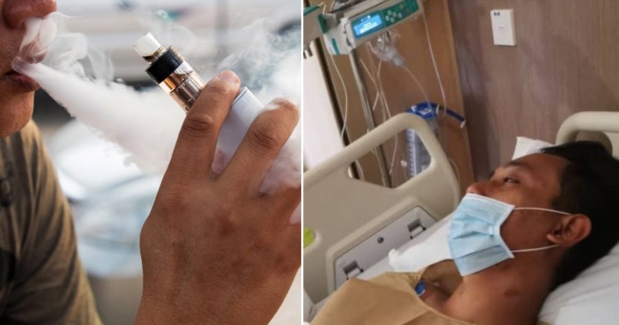 34yo M'sian Man Has Fluid-Like Fungus in His Lungs After Switching to Vape for 2 Weeks - WORLD OF BUZZ
