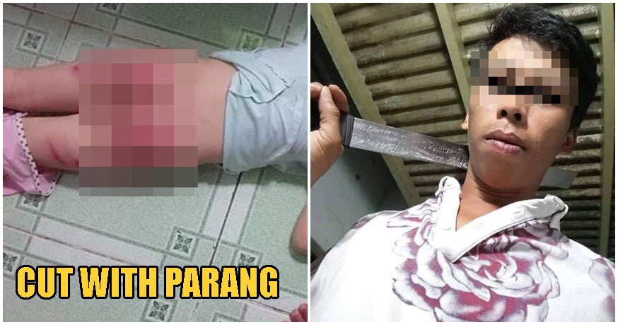 Cruel S'wak Man Allegedly Abuses Toddler Daughter, Cuts Her BARE BUTTOCKS With Parang - WORLD OF BUZZ 1
