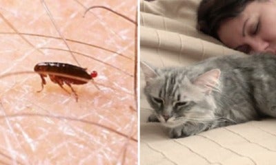 Girl Hears Weird Rustling Sound In Ear, Discovers It'S Fleas From Sleeping With Cat - World Of Buzz