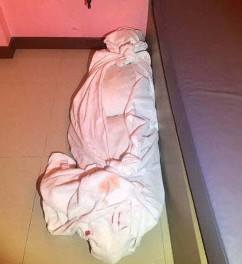 Horrifying Moment Hotel Staff Finds Bloody 'Corpse' Beside the Bed, But Po - WORLD OF BUZZ 3