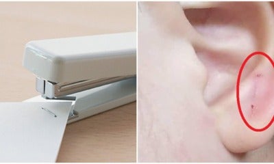 Kuching Kindergarten Teacher Allegedly Staples 4Yo Boy'S Ear, Principal Only Apologised Without Explanation - World Of Buzz 1
