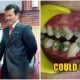 Moh: Using Fake Braces Puts You At Risk Of Contracting Hiv &Amp; Other Diseases - World Of Buzz