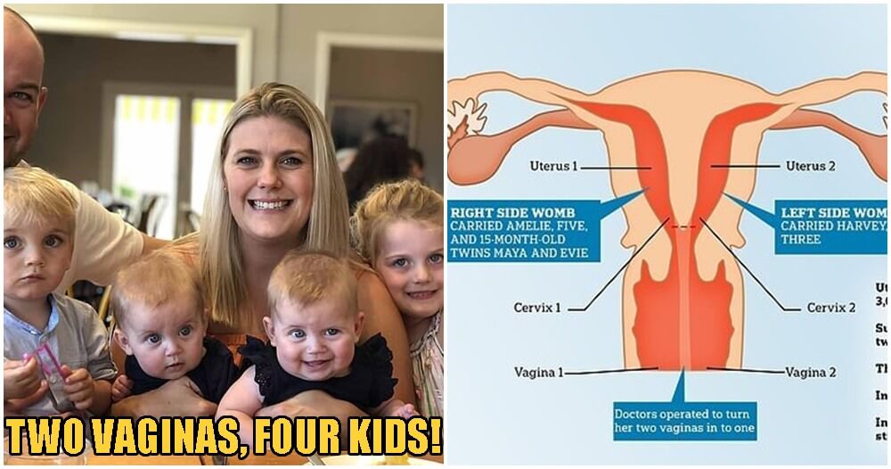 mother with two vaginas two wombs delivers four children world of buzz 6
