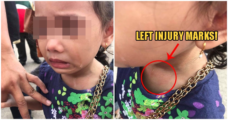 Penang Toddler Gets Her Necklace Ripped From Her Neck At Open-Air Market - World Of Buzz