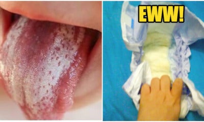 'Petua' Rubbing Baby'S Tongue With Pee To Clean It Is Denied By Doctor - World Of Buzz 2