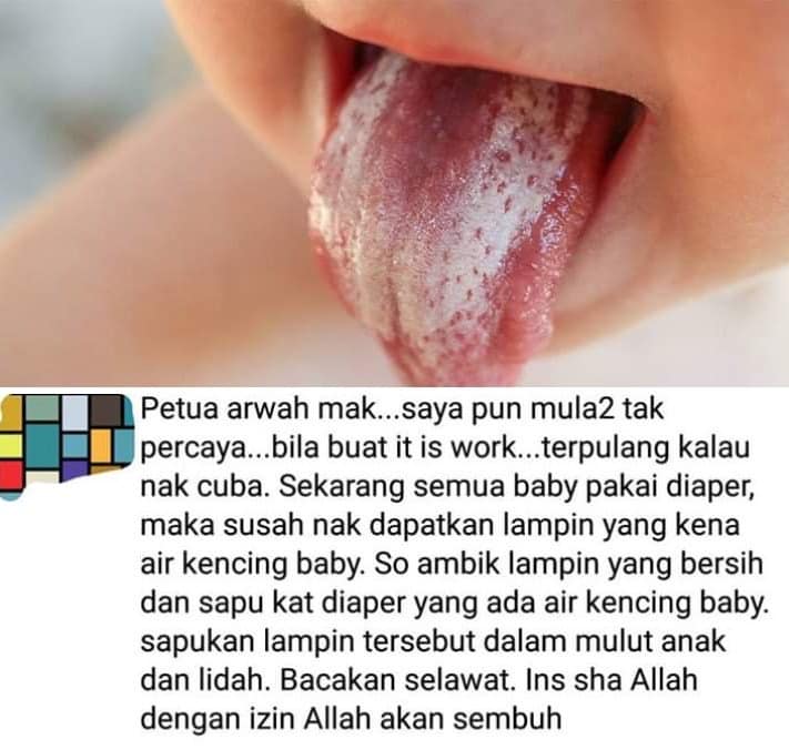 'Petua' Rubbing Baby's Tongue With Pee To Clean It Is Denied By Doctor - WORLD OF BUZZ