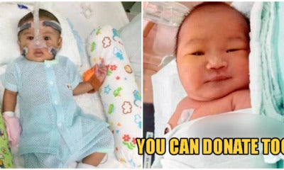 These 2 Babies Need Rm130,000 For Life-Saving Surgery; Here'S How You Can Help! - World Of Buzz