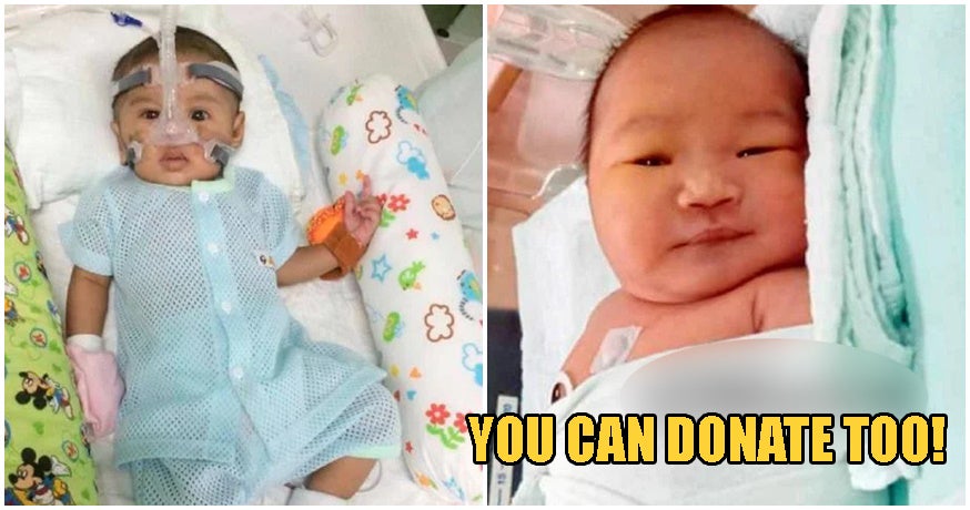 These 2 Babies Need RM130,000 For Life-Saving Surgery; Here's How You Can Help! - WORLD OF BUZZ