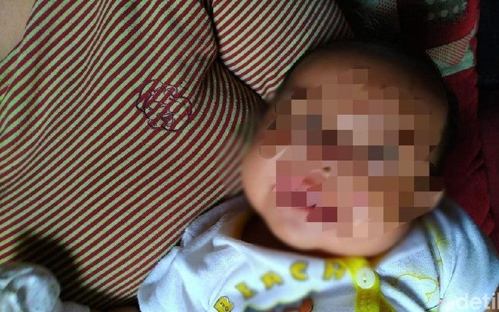 1-Month-Old Baby Gets Bitten By Huge Rat While Sleeping, Suffers Deep Wounds & Needs Stitches - WORLD OF BUZZ 1